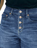 Closeup view of blue raw hem mid-waist distressed denim shorts